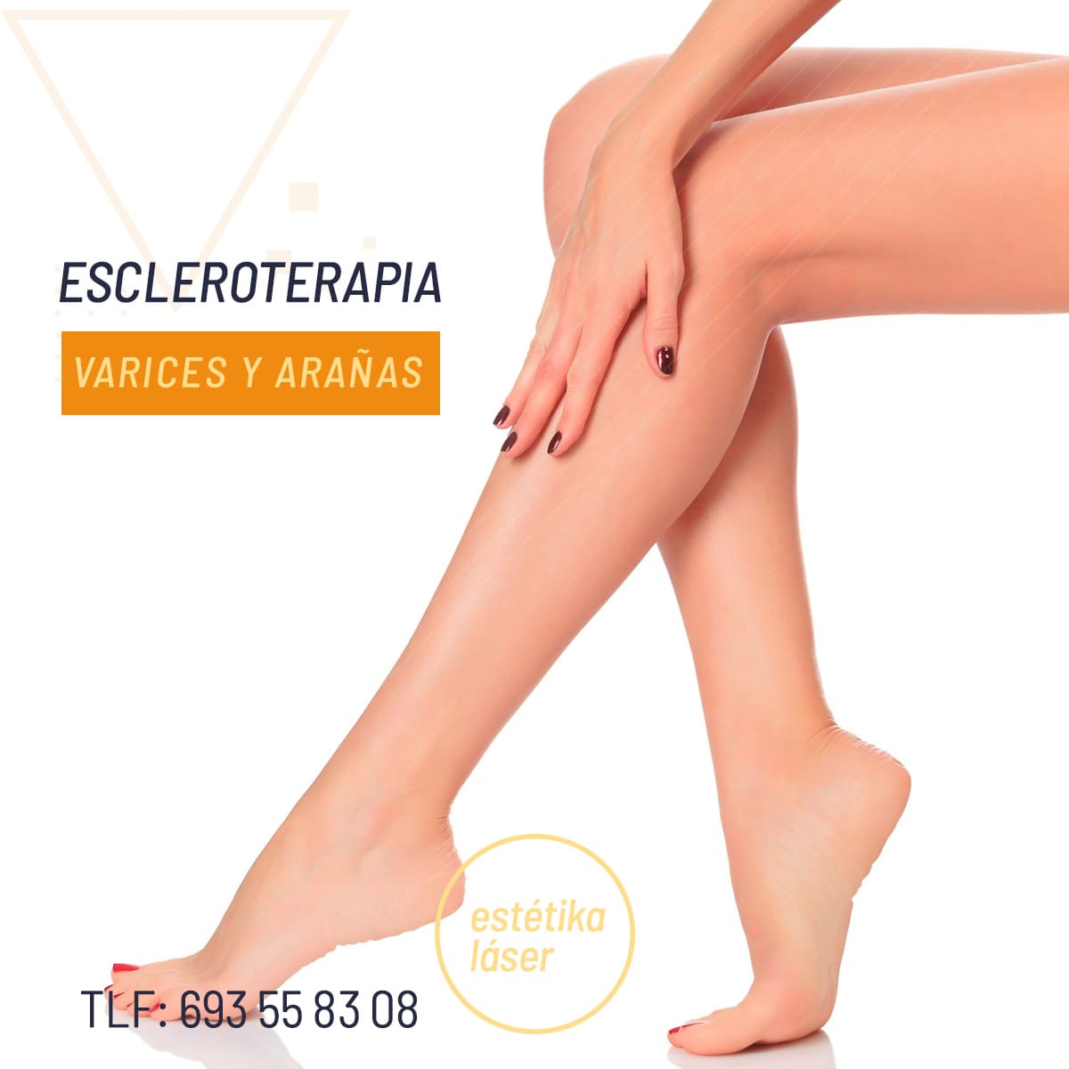 estetica avanzada murcia escleroterapia varices estrias 3